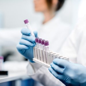 lab-testing Lab Testing at Immunize El Paso office